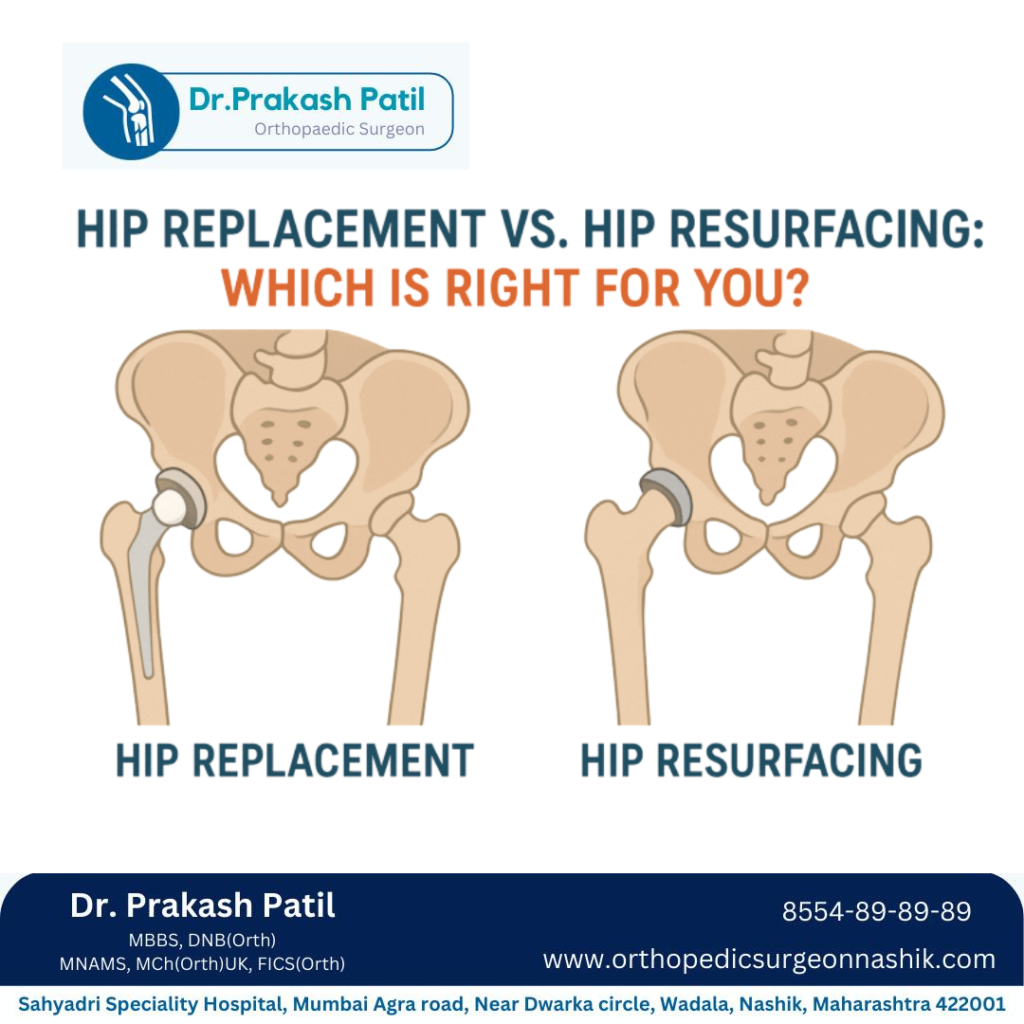 Hip replacement in Nashik