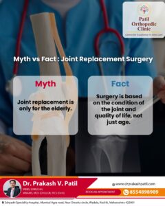 Myth vs Fact: Joint Replacement Surgery in Nashik